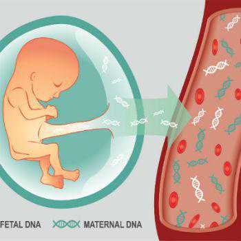 孕妇要做无创DNA，为何在这个时间检查最好？医生不说但你要知道