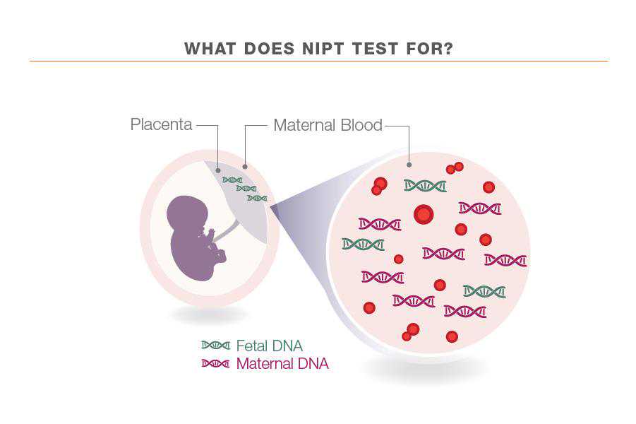 孕妇要做无创DNA，为何在这个时间检查最好？医生不说但你要知道